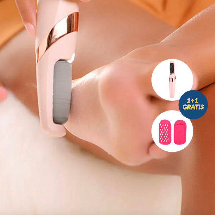 FeetBundle, elektromos bőrkeményedés eltávolító roller + zokni száraz és repedezett lábakhoz INGYEN - Image 2