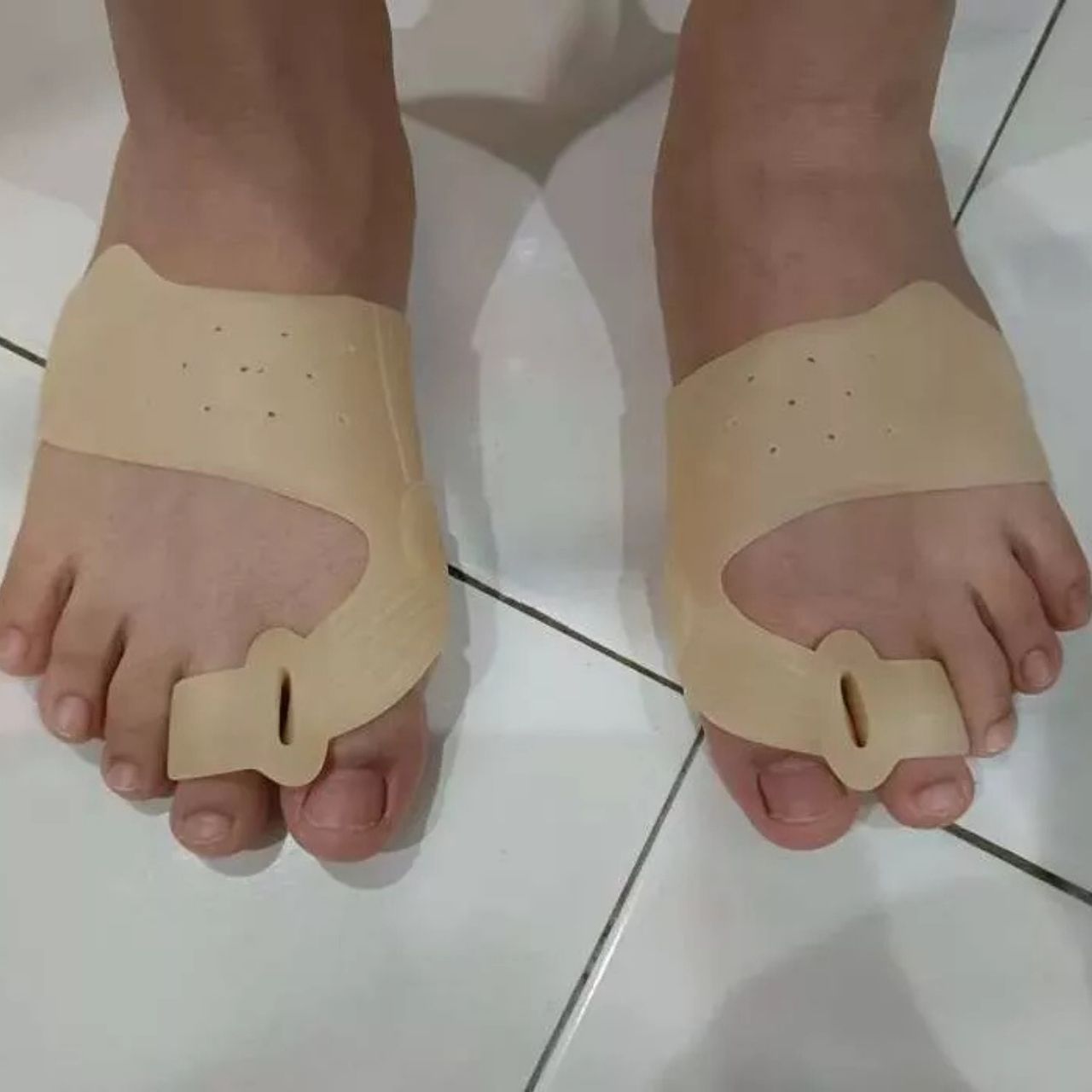ToeCorrect, egy lábujjkorrekciós sín - Image 14
