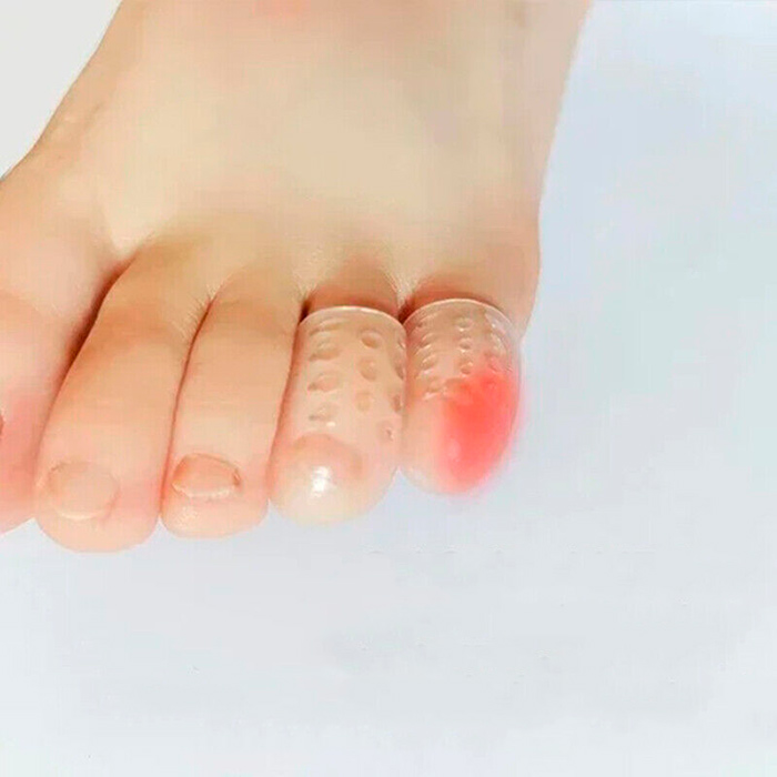 ToeProtector, szilikon lábujjvédő (10 db) - Image 8